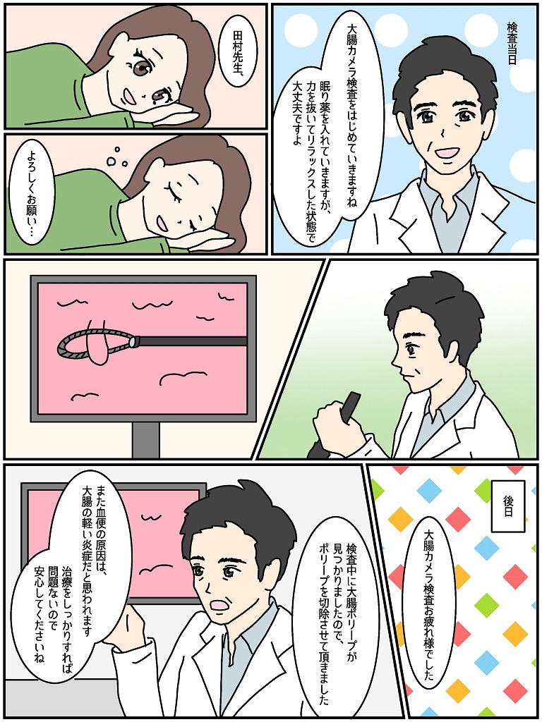 大腸カメラ7